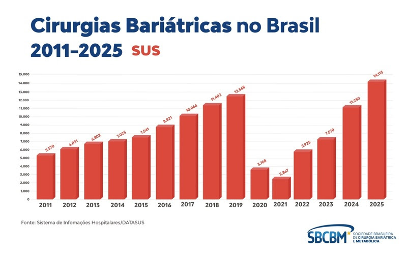 Mutirão inédito vai realizar 200 cirurgias bariátricas pelo SUS em 10 estados no Dia Mundial de Combate à Obesidade